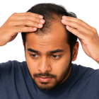 Hair fall